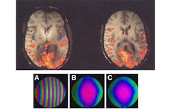 Electronicdesign Com Sites Electronicdesign com Files Uploads 2014 03 105551 Fig1 Mri Electronicdesign Com Sites Electronicdesign com Files Uploads 2014 03 105551 Fig1 Mri