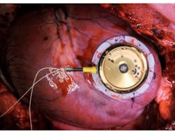 Powerelectronics Com Sites Powerelectronics com Files Uploads 2014 09 Ener Harv F1 Powerelectronics Com Sites Powerelectronics com Files Uploads 2014 09 Ener Harv F1