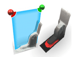 Goepel Meniskus 300x219 Goepel Meniskus 300x219