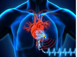 Www Powerelectronics Com Sites Powerelectronics com Files Pacemaker Batt Fig1 Www Powerelectronics Com Sites Powerelectronics com Files Pacemaker Batt Fig1