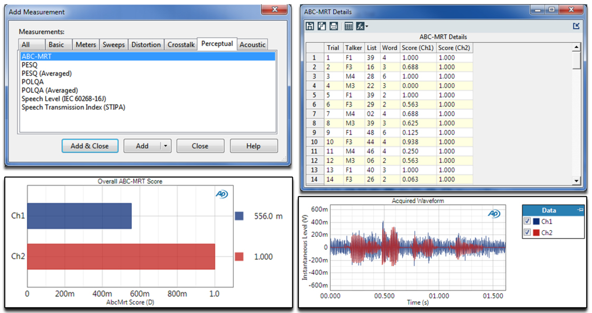 Ap Abc Mrt Measurement Results