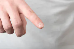 Si Time 1508 Csp Part On Finger Si Time 1508 Csp Part On Finger