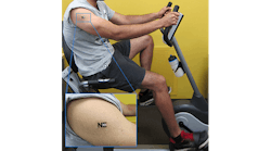 The lactate levels produced during exercise are detected by a tattoo biosensor.