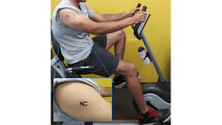 The lactate levels produced during exercise are detected by a tattoo biosensor The lactate levels produced during exercise are detected by a tattoo biosensor