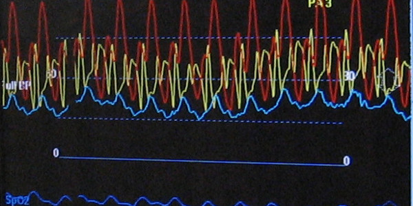 Electronicdesign 9172 74763 tab2