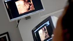 Processes Combine to Deliver 16-Channel Beamforming Ultrasound Pulser IC