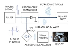 Electronicdesign Com Sites Electronicdesign com Files Fig02 Ultrasound System 0 Electronicdesign Com Sites Electronicdesign com Files Fig02 Ultrasound System 0