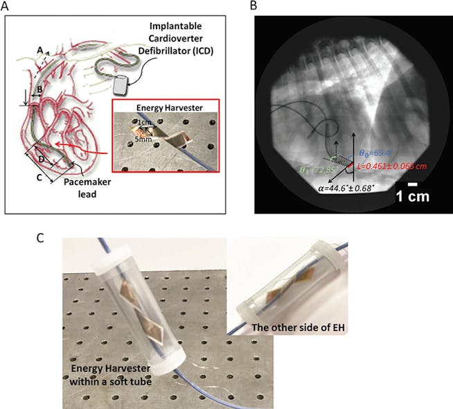PiezoBased Energy Harvesting for Medical Implants May Transcend