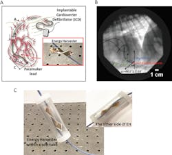 Electronicdesign Com Sites Electronicdesign com Files Pet Pacemaker Harvesting Fig1 Web Electronicdesign Com Sites Electronicdesign com Files Pet Pacemaker Harvesting Fig1 Web