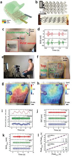 1. Shown are various aspects of the stretchable PVDF vibration sensor (i.e. PVDF e-tattoo) and 3D method for SCG measurement: A schematic of the stretchable PVDF e-tattoo (a); photographs of an undeformed and stretched PVDF e-tattoo (b); the PVDF e-tattoo (red boxed) and a commercial accelerometer (green arrowed) attached on human chest (c); SCG signals measured by the PVDF e-tattoo and the accelerometer (d); a photograph of the 3D setup for mapping human chest deformation (e); a photograph of a human chest mounted with three PVDF e-tattoos and painted with a random speckle pattern (positions of the three e-tattoos are denoted as Top, Mid., and Bot. (f); the out-of-plane displacement map averaged at S1 and S2 peak times, respectively (g,h); measured signals by 3D DIC method (raw, filtered) and the accelerometer (Acc.) from the chest (i); SCG signals at three different positions (Top, Mid., and Bot.) captured by 3D method and PVDF e-tattoos, respectively (j,k); the correlation of SCG peak times (S1 and S2) measured by the 3D method, PVDF e-tattoo, and the accelerometer (l). (Source: University of Texas) 1. Shown are various aspects of the stretchable PVDF vibration sensor (i.e. PVDF e-tattoo) and 3D method for SCG measurement: A schematic of the stretchable PVDF e-tattoo (a); photographs of an undeformed and stretched PVDF e-tattoo (b); the PVDF e-tattoo (red boxed) and a commercial accelerometer (green arrowed) attached on human chest (c); SCG signals measured by the PVDF e-tattoo and the accelerometer (d); a photograph of the 3D setup for mapping human chest deformation (e); a photograph of a human chest mounted with three PVDF e-tattoos and painted with a random speckle pattern (positions of the three e-tattoos are denoted as Top, Mid., and Bot. (f); the out-of-plane displacement map averaged at S1 and S2 peak times, respectively (g,h); measured signals by 3D DIC method (raw, filtered) and the accelerometer (Acc.) from the chest (i); SCG signals at three different positions (Top, Mid., and Bot.) captured by 3D method and PVDF e-tattoos, respectively (j,k); the correlation of SCG peak times (S1 and S2) measured by the 3D method, PVDF e-tattoo, and the accelerometer (l). (Source: University of Texas)