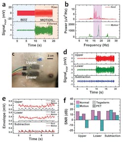 4. Dual-sensor-based motion artifact cancellation scheme: Raw and filtered SCG signals captured by one PET-covered PVDF sensor under rest (blue shaded) and motion (yellow shaded) conditions (a); periodograms of the filtered SCG signals under rest and motion conditions (b); a photograph of the dual sensor system attached on a human chest (c); filtered SCG signals (d) and corresponding envelopes (e) recorded by upper and lower PVDF sensors and their subtraction result under normal and motion conditions; signal-to-noise ratios (SNR) of single and dual sensor systems with different substrates (PET vs Tegaderm) under normal and motion conditions (f). (Source: University of Texas) 4. Dual-sensor-based motion artifact cancellation scheme: Raw and filtered SCG signals captured by one PET-covered PVDF sensor under rest (blue shaded) and motion (yellow shaded) conditions (a); periodograms of the filtered SCG signals under rest and motion conditions (b); a photograph of the dual sensor system attached on a human chest (c); filtered SCG signals (d) and corresponding envelopes (e) recorded by upper and lower PVDF sensors and their subtraction result under normal and motion conditions; signal-to-noise ratios (SNR) of single and dual sensor systems with different substrates (PET vs Tegaderm) under normal and motion conditions (f). (Source: University of Texas)