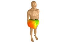 Ansys Hbm Insulin Ansys Hbm Insulin