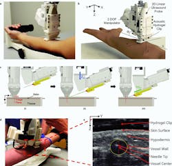 2. Robotic device set-up and operation: (a) Handheld venipuncture device. (b) Computer-aided design (CAD) displaying key components of the two-degree-of-freedom (DoF) device. Angle of insertion (&theta;) is fixed at 25 degrees. (c) Device operation: (i) Ultrasound (US) imaging plane provides a cross-sectional view of target vessel. (ii) Once a vessel is located by the device, the needle is aligned via the Z-axis motion (Zm) DoF motor; the Zm motor (blue arrow) is responsible for aligning the needle trajectory with the vessel depth (Z-axis) to ensure the needle tip reaches the vessel center exactly at the ultrasound imaging plane. (iii) Once trajectory is aligned, the needle is inserted via the injection motion (Inj m) DoF motor (green arrow) and automatically halted once the tip has reached the vessel center. (d) Device positioned over the upper forearm during the study. (e) Ultrasound image depicting the needle tip present in the target vessel after a successful venipuncture. Vessel wall is identified by a yellow dashed ellipse. The Z-axis in the image indicates the vessel depth and the Y-axis indicates the sagittal position of the vessel. Positions of the vessel and needle tip are recorded with respect to the ultrasound transducer head (top of image).