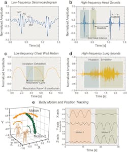 3. Recording cardiopulmonary vibrations, sounds, and body motion: (a) Time-domain plot of measured seismocardiogram (SCG) signal. Peaks corresponding to occurrence of closing of mitral valve (MC), opening of aortic valve (AO), closing of aortic valve (AC), and opening of mitral valve (MO) are indicated. (b) Recorded waveforms of two cardiac cycles showcasing sensitivity to the two major cardiac sounds (S1 and S2). Time intervals of inter-beat, systole, and diastole are specified. (c) Sensor output signal representing motion of the chest wall during deep-breathing respiratory cycles. Time intervals of inhalation and exhalation are identified for computation of respiratory rate. (d) High-frequency lung sounds of inhalation and exhalation as recorded by the vibration microsensor. (e) Body-motion tracking in three dimensions using the ACM along with two in-plane accelerometers, as the individual performs side-to-side (orange) and frontal (green) bending exercises. Time-domain plots recorded during exercising show the wide dynamic range of the sensor. 3. Recording cardiopulmonary vibrations, sounds, and body motion: (a) Time-domain plot of measured seismocardiogram (SCG) signal. Peaks corresponding to occurrence of closing of mitral valve (MC), opening of aortic valve (AO), closing of aortic valve (AC), and opening of mitral valve (MO) are indicated. (b) Recorded waveforms of two cardiac cycles showcasing sensitivity to the two major cardiac sounds (S1 and S2). Time intervals of inter-beat, systole, and diastole are specified. (c) Sensor output signal representing motion of the chest wall during deep-breathing respiratory cycles. Time intervals of inhalation and exhalation are identified for computation of respiratory rate. (d) High-frequency lung sounds of inhalation and exhalation as recorded by the vibration microsensor. (e) Body-motion tracking in three dimensions using the ACM along with two in-plane accelerometers, as the individual performs side-to-side (orange) and frontal (green) bending exercises. Time-domain plots recorded during exercising show the wide dynamic range of the sensor.