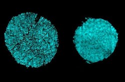 X-ray tomography images taken at Brookhaven National Lab show cracking of a particle in one electrode of a battery cell that used a conventional electrolyte (as seen on the left). The researchers found that using a novel electrolyte prevented most of this cracking (right). (Courtesy of the researchers) X-ray tomography images taken at Brookhaven National Lab show cracking of a particle in one electrode of a battery cell that used a conventional electrolyte (as seen on the left). The researchers found that using a novel electrolyte prevented most of this cracking (right). (Courtesy of the researchers)