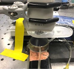 4. Focused ultrasound pulses are applied to motes embedded in ultrasound gel for in vitro test and evaluation. 4. Focused ultrasound pulses are applied to motes embedded in ultrasound gel for in vitro test and evaluation.