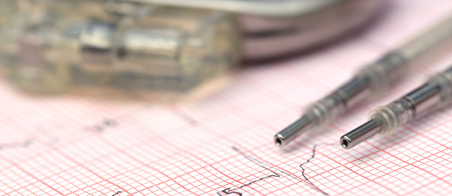 Pacemaker Mohammed Anwarul Kabir Choudhury Dreamstime L 51106898 起搏器Mohammed Anwarul Kabir Choudhury dreamtime l51106898