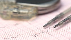 Pacemaker Mohammed Anwarul Kabir Choudhury Dreamstime L 51106898 61b26fdb2b0f9 Pacemaker Mohammed Anwarul Kabir Choudhury Dreamstime L 51106898 61b26fdb2b0f9