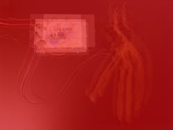 5. Having a hard time typing a caption, too much… everything. Ahhhhhhh! 5. Having a hard time typing a caption, too much… everything. Ahhhhhhh!