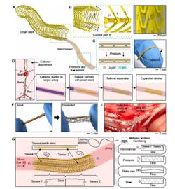1. Overview of a fully implantable, wireless vascular electronic system with printed sensors for wireless monitoring of hemodynamics: (A) Illustration of the implantable electronic components. (B) Inductive stent design using conductive Au loops and nonconductive polyimide (PI) connectors to achieve a current path resembling a solenoid (left) and a scanning electron microscopy (SEM) image of the stent (right). (C) Layers of the soft pressure sensor using a printed dielectric layer (left) and photo of index finger holding a simultaneous flow and pressure sensor (right). AgNP, silver nanoparticle; PDMS, polydimethylsiloxane. (D) Illustration of minimally invasive catheter deployment and balloon expansion of the wireless vascular stent. (E) Initial and expanded state of the sensor-integrated stent system. (F) Wireless stent system implanted in the right iliac artery of living rabbit. (G) Illustration of the wireless design and sensing scheme to simultaneously monitor pressure, heart rate (HR), and flow. 1. Overview of a fully implantable, wireless vascular electronic system with printed sensors for wireless monitoring of hemodynamics: (A) Illustration of the implantable electronic components. (B) Inductive stent design using conductive Au loops and nonconductive polyimide (PI) connectors to achieve a current path resembling a solenoid (left) and a scanning electron microscopy (SEM) image of the stent (right). (C) Layers of the soft pressure sensor using a printed dielectric layer (left) and photo of index finger holding a simultaneous flow and pressure sensor (right). AgNP, silver nanoparticle; PDMS, polydimethylsiloxane. (D) Illustration of minimally invasive catheter deployment and balloon expansion of the wireless vascular stent. (E) Initial and expanded state of the sensor-integrated stent system. (F) Wireless stent system implanted in the right iliac artery of living rabbit. (G) Illustration of the wireless design and sensing scheme to simultaneously monitor pressure, heart rate (HR), and flow.