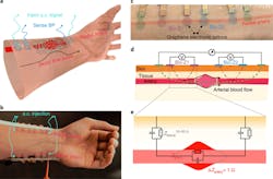 Ed Blood Pressure Tattoo Interest Fig1 Ed Blood Pressure Tattoo Interest Fig1