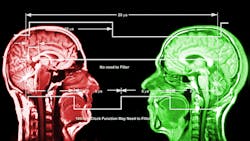 X Ray Dreamstime Markwaters 12854017promo2 62e9318a9a631 X Ray Dreamstime Markwaters 12854017promo2 62e9318a9a631