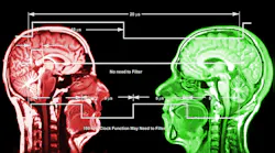 X Ray Dreamstime Markwaters 12854017promo2