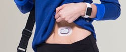 2. For people with diabetes, skin-attached blood-sugar measurement devices such as this unit from Dexcom eliminate the need to make multiple daily finger pricks and then using test strips for measurement, while providing accurate data in near real-time.