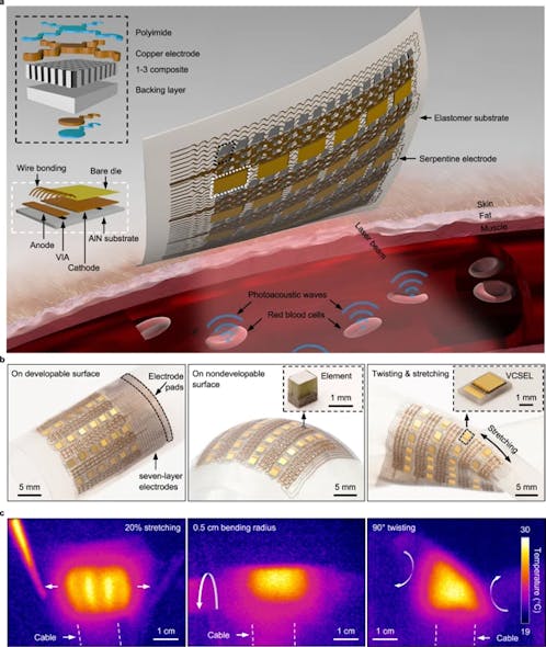 2. (a) Schematics of the device structure and the working principle. The patch comprises an array of VCSELs and an array of piezoelectric transducers, interconnected by serpentine copper electrodes. Upon absorption of the optical energy, the hemoglobin molecules in red blood cells undergo thermoelastic expansion and radiate acoustic waves into the surrounding media. The photoacoustic waves will be collected by the transducer array and then relayed to a backend system for data processing. (b) Optical photographs of the soft photoacoustic patch under different modes of deformation, including bending on a developable surface, wrapping on a nondevelopable surface, and stretching and twisting. Insets in the middle and right panels are optical micrographs of a single transducer element and a VCSEL diode, respectively. (c) Infrared camera images of the soft photoacoustic patch when the VCSELs are in operation under different modes of deformation, including stretching, bending, and twisting.