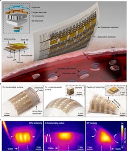 2. (a) Schematics of the device structure and the working principle. The patch comprises an array of VCSELs and an array of piezoelectric transducers, interconnected by serpentine copper electrodes. Upon absorption of the optical energy, the hemoglobin molecules in red blood cells undergo thermoelastic expansion and radiate acoustic waves into the surrounding media. The photoacoustic waves will be collected by the transducer array and then relayed to a backend system for data processing. (b) Optical photographs of the soft photoacoustic patch under different modes of deformation, including bending on a developable surface, wrapping on a nondevelopable surface, and stretching and twisting. Insets in the middle and right panels are optical micrographs of a single transducer element and a VCSEL diode, respectively. (c) Infrared camera images of the soft photoacoustic patch when the VCSELs are in operation under different modes of deformation, including stretching, bending, and twisting. 2. (a) Schematics of the device structure and the working principle. The patch comprises an array of VCSELs and an array of piezoelectric transducers, interconnected by serpentine copper electrodes. Upon absorption of the optical energy, the hemoglobin molecules in red blood cells undergo thermoelastic expansion and radiate acoustic waves into the surrounding media. The photoacoustic waves will be collected by the transducer array and then relayed to a backend system for data processing. (b) Optical photographs of the soft photoacoustic patch under different modes of deformation, including bending on a developable surface, wrapping on a nondevelopable surface, and stretching and twisting. Insets in the middle and right panels are optical micrographs of a single transducer element and a VCSEL diode, respectively. (c) Infrared camera images of the soft photoacoustic patch when the VCSELs are in operation under different modes of deformation, including stretching, bending, and twisting.