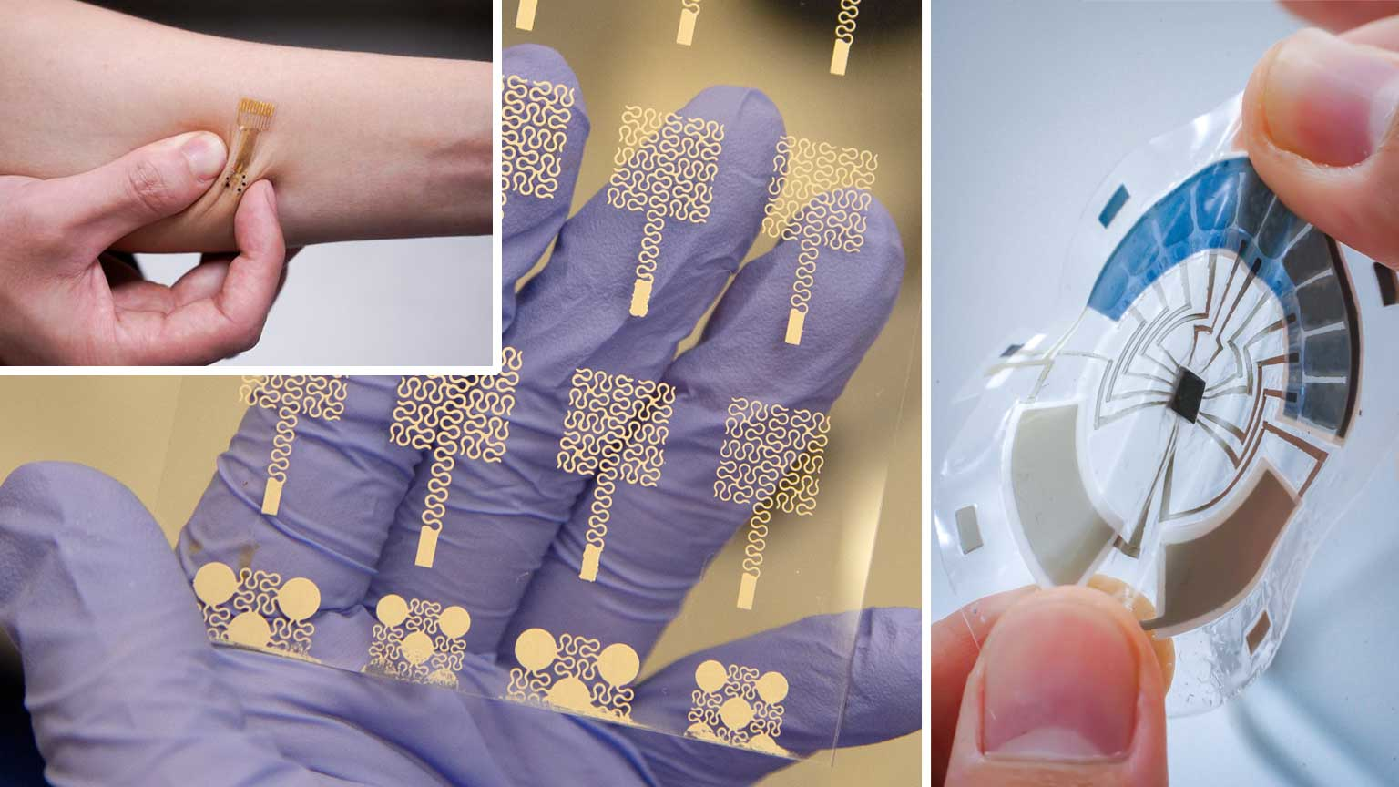 Wearable Skin Patches: The “Hot” Medical Research Field | Electronic Design