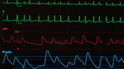 photo_82095029__tloventures__dreamstime photo_82095029__tloventures__dreamstime