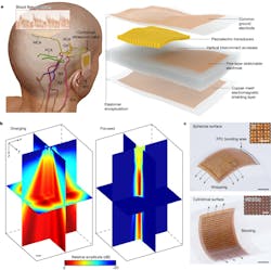 4. Overview of the conformal ultrasound patch for TCD: (a) Schematic of the working configuration and patch structure. The patch is attached to the scalp for volumetric mapping of the major arteries in the brain. Blood-flow spectra of different target arteries are recorded. The patch consists of a 16 × 16 array of piezoelectric transducers connected by a five-layer stretchable electrode and a common ground electrode. A copper mesh is used as an electromagnetic shielding layer to enhance the signal-to-noise ratio. The entire device is encapsulated by a waterproof and biocompatible silicone elastomer. (b) Simulation results of diverging and focused ultrasound fields based on 2D matrix array beamforming. The simulation was performed using an open-source MATLAB toolbox Field II. (c) Optical images of the patch on a spherical surface and a cylindrical surface. The insets show the magnified transducer array (top) and the electromagnetic shielding layer (bottom). BA, basal artery; VA, vertebral arteries; OA, ophthalmic arteries; FFC, flat flexible cable; Tx, transducers. Scale bars, 5 mm (b,c); 1 mm (c, insets). 4. Overview of the conformal ultrasound patch for TCD: (a) Schematic of the working configuration and patch structure. The patch is attached to the scalp for volumetric mapping of the major arteries in the brain. Blood-flow spectra of different target arteries are recorded. The patch consists of a 16 × 16 array of piezoelectric transducers connected by a five-layer stretchable electrode and a common ground electrode. A copper mesh is used as an electromagnetic shielding layer to enhance the signal-to-noise ratio. The entire device is encapsulated by a waterproof and biocompatible silicone elastomer. (b) Simulation results of diverging and focused ultrasound fields based on 2D matrix array beamforming. The simulation was performed using an open-source MATLAB toolbox Field II. (c) Optical images of the patch on a spherical surface and a cylindrical surface. The insets show the magnified transducer array (top) and the electromagnetic shielding layer (bottom). BA, basal artery; VA, vertebral arteries; OA, ophthalmic arteries; FFC, flat flexible cable; Tx, transducers. Scale bars, 5 mm (b,c); 1 mm (c, insets).