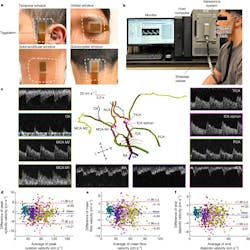 5. Validation of cerebral blood flow measurements: (a) Optical images of the conformal ultrasound patch on four different transcranial windows, including the temporal, orbital, submandibular, and suboccipital windows. (b) Optical image of the complete setup. It includes the ultrasound patch connected to a Verasonics system by shielded cables. The host computer controls the Verasonics system for data acquisition and processing. The blood flow spectrum is displayed on the monitor. (c) Examples of blood-flow spectra recorded from representative arterial segments from a participant using the ultrasound patch. The spectra share the same scale bars. (d-f) Bland-Altman plots of peak systolic velocity (d), mean flow velocity (e), and end diastolic velocity (f) measured by the ultrasound patch and a conventional TCD probe on the participants. Solid blue lines are the mean differences in the measurements between the two modalities. Solid red lines are 95% limits of agreement and black dash lines are the zero difference of the measurements between the two modalities. Each plot has 762 data points that are color-coded for different arterial segments (that is, cider for ACA, dark cyan for ophthalmic arteries (OA), xanthic for MCA M2, juniper for MCA M1, boysenberry for basal artery (BA), blueberry for vertebral arteries (VA), hibiscus for ICA, Kelly green for PCA, magenta for ICA siphon and carnation pink for TICA). FFC, flat flexible cable; L, left; R, right; A, anterior; P, posterior. Scale bar, 2 cm (a). 5. Validation of cerebral blood flow measurements: (a) Optical images of the conformal ultrasound patch on four different transcranial windows, including the temporal, orbital, submandibular, and suboccipital windows. (b) Optical image of the complete setup. It includes the ultrasound patch connected to a Verasonics system by shielded cables. The host computer controls the Verasonics system for data acquisition and processing. The blood flow spectrum is displayed on the monitor. (c) Examples of blood-flow spectra recorded from representative arterial segments from a participant using the ultrasound patch. The spectra share the same scale bars. (d-f) Bland-Altman plots of peak systolic velocity (d), mean flow velocity (e), and end diastolic velocity (f) measured by the ultrasound patch and a conventional TCD probe on the participants. Solid blue lines are the mean differences in the measurements between the two modalities. Solid red lines are 95% limits of agreement and black dash lines are the zero difference of the measurements between the two modalities. Each plot has 762 data points that are color-coded for different arterial segments (that is, cider for ACA, dark cyan for ophthalmic arteries (OA), xanthic for MCA M2, juniper for MCA M1, boysenberry for basal artery (BA), blueberry for vertebral arteries (VA), hibiscus for ICA, Kelly green for PCA, magenta for ICA siphon and carnation pink for TICA). FFC, flat flexible cable; L, left; R, right; A, anterior; P, posterior. Scale bar, 2 cm (a).