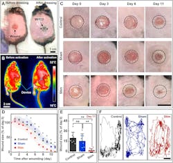 In vivo evaluation of the WPED in db/db (diabetic) mice In vivo evaluation of the WPED in db/db (diabetic) mice