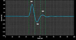 6. These measured waveforms are used to calculate the equivalent Joule integral (I2t) for evaluating fuse performance under pulse conditions. The oscilloscope capture of inrush current pulses is divided into three segments (W1, W2, and W3). 6. These measured waveforms are used to calculate the equivalent Joule integral (I2t) for evaluating fuse performance under pulse conditions. The oscilloscope capture of inrush current pulses is divided into three segments (W1, W2, and W3).