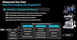 In real-time medical imaging, the main processor must be able to deliver deterministic signal processing within strict power and form-factor limits